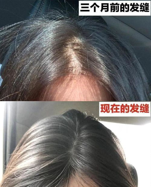 屈臣氏有一款洗发水,控油去屑还防脱,洗一洗头发清爽蓬松还顺滑