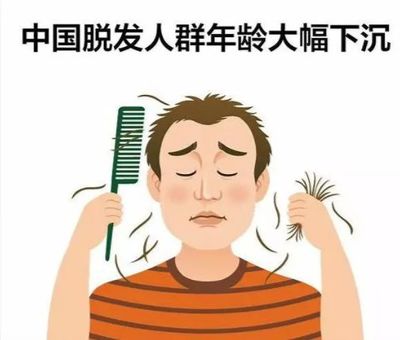 男性的脂溢性脱发都表现在哪里?什么年纪是脱发高峰期?