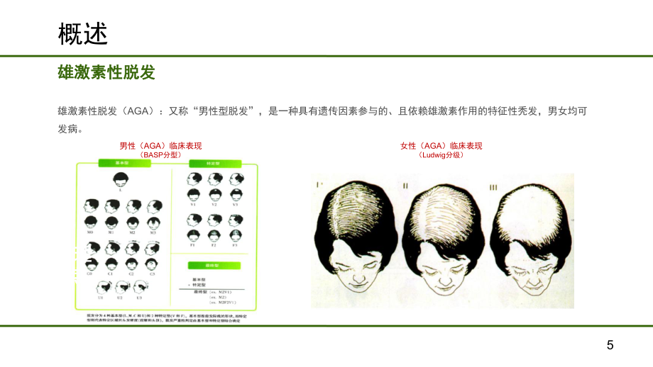 雄激素性脱发非药物治疗(课堂PPT)