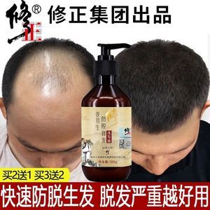 担心产后变秃头,了解产后脱发那些事儿